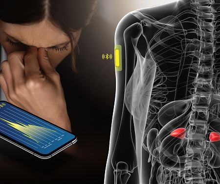 (Paper) Signs of Burnout Can be Detected in Sweat