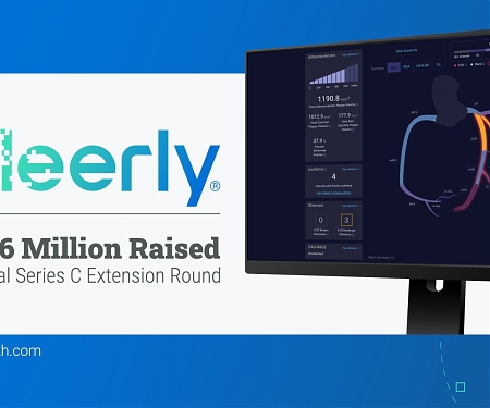Cleerly Raises $106M for AI Heart Health Early Detection