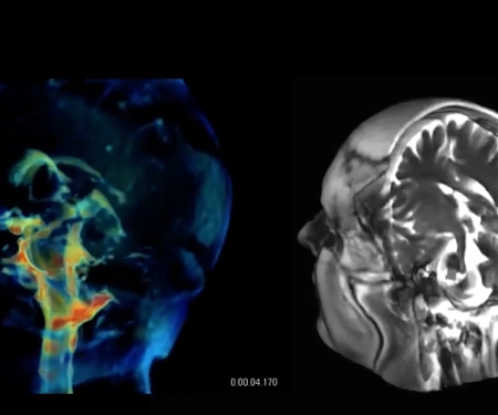 (Paper) New Imaging Tech Offers Incredibly Detailed 3D Videos of Pulsating Brains
