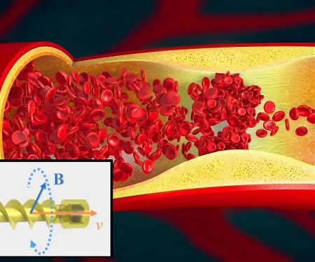 (Video) Clot-busting "Millirobots" Corkscrew Their Way Through Blood Vessels