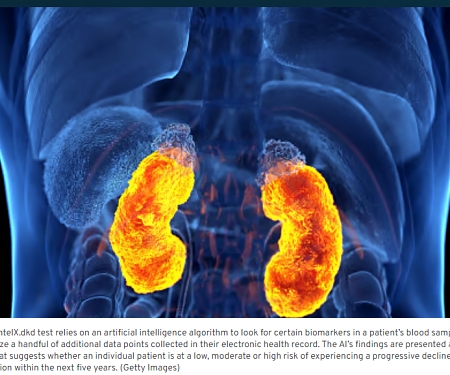 Renalytix Scores Long-Awaited FDA De Novo Nod for AI-Powered Kidney Disease Test