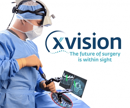 AR Tool Used to Aid Spinal Surgeons - Augmedic