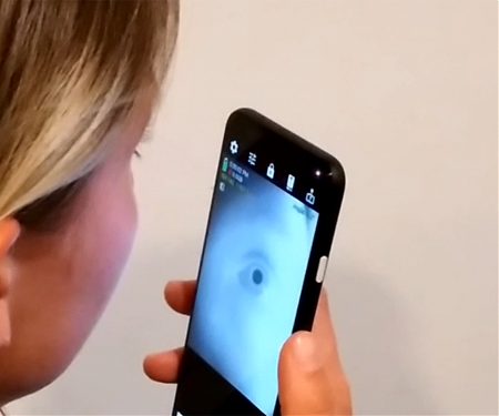 (Video) At-Home Pupillometry Using Smartphone Facial Identification Cameras