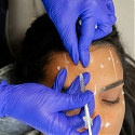 Inside South Korea’s Cosmetic Tourism Boom