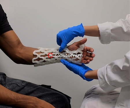 Castomize Rethinks The Orthopedic Cast As A Breathable ‘4D-Printed’ Lattice Shell