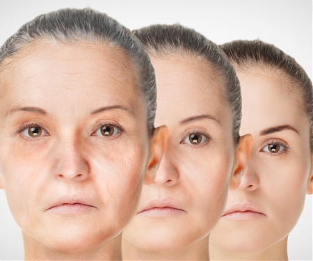 New Technique Rewinds The Age of Skin Cells by 30 Years