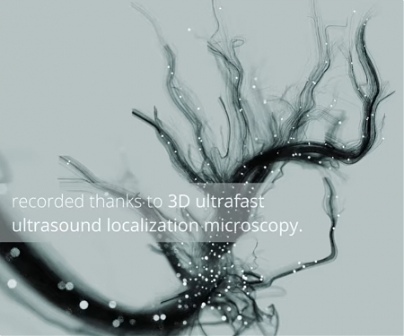 (Video) Major Advance in 3D Ultrasound Imaging to Observe Entire Organs