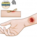 Stanford - Wireless Smart Bandage Provides New Insights On Healing Chronic Wounds