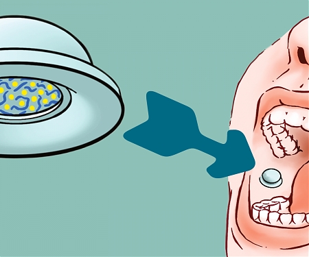 Octopus Tentacle-like Patch Delivers Drugs Through Your Cheek