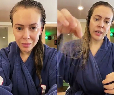 In Serious Cases, Covid-19 Symptoms Can Linger for a Long Time