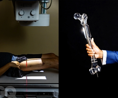 Workers from Google, Microsoft, Amazon Are Paying $75,000 to Get 3 Inch Taller