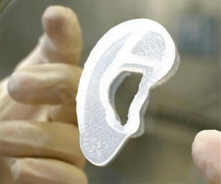 3DBio is Trialling a Method for 3D-Printing an Artificial Exterior Ear