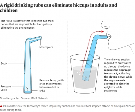 (Paper) Drinking Straw Device is Instant Cure for Hiccups - Hiccaway
