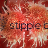Stipple Bio Rasied $100M Series A Financingf For Targeted Cancer Therapies