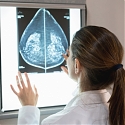 MIT’s AI Accurately Identifies Breast Cancer Like A Radiologist Would