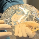 The First Transparent 3D-Printed Skull Has Been Successfully Implanted