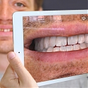 (Video) Augmented Reality for the Future of Dentistry - Kapanu