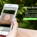 Skin Cancer Checker App, SkinVision, Snags $3.4M To Move Beyond Moles