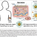 (PDF) Topical Skin Lotion to Detect Variety of Disease Biomarkers