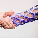 These Gel-Filled Casts are Breathable, Waterproof, and Look Cool - Cast21
