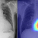 (Paper) AI Transforms The Humble Chest X-Ray Into a Better Diagnostic Tool