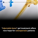 EPFL - An Injectable Hydrogel for Local Bone Densification