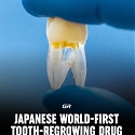 World's First Tooth-Regenerating Drug to Enter Testing in Japan