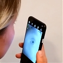 (Video) At-Home Pupillometry Using Smartphone Facial Identification Cameras